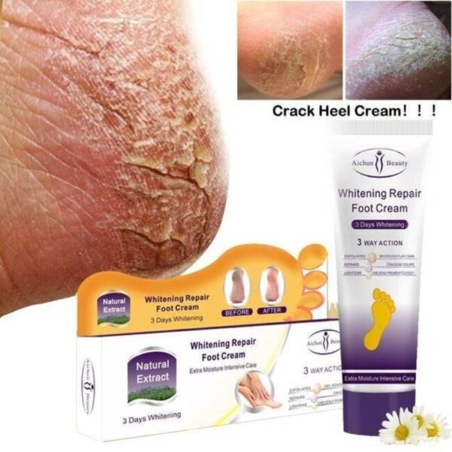 Aichun Beauty Whitening Repair Foot Cream -100ml